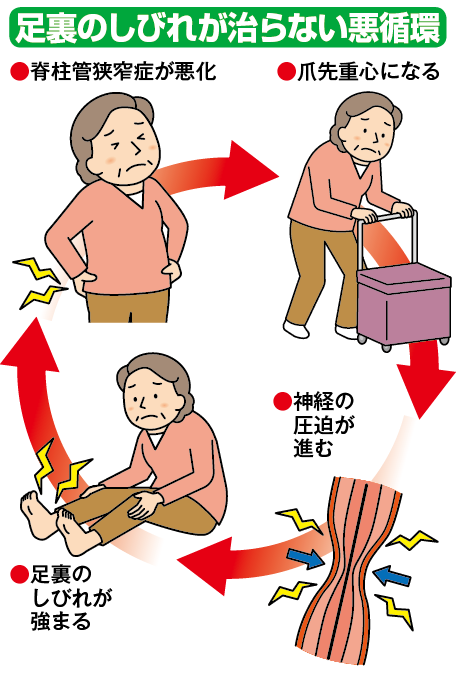 足裏のしびれ 違和感 血流アップに役立つ 足指広げ で改善 整形外科専門医解説 カラダネ